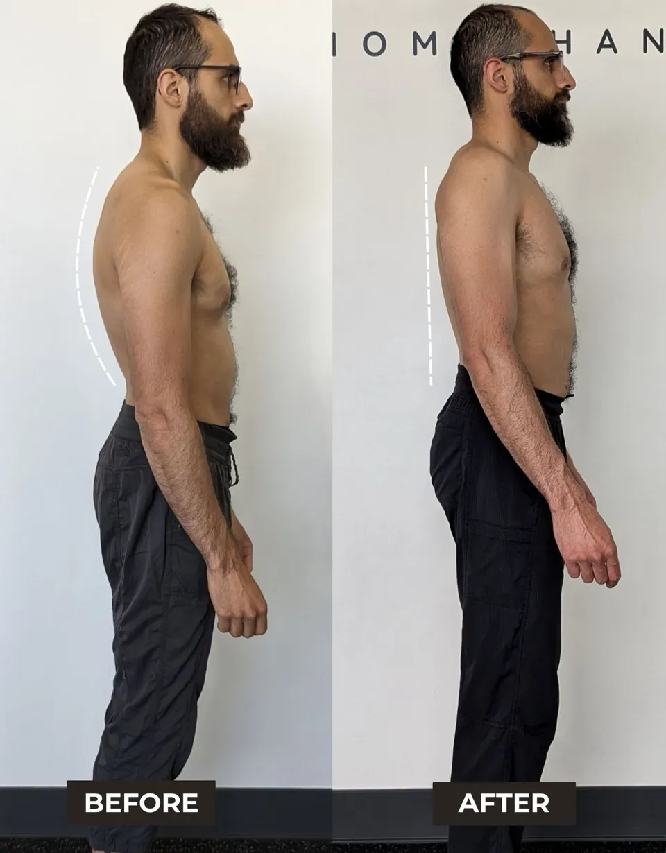 Client side profile before and after training: a rounded upper back before, an upright, stacked torso after