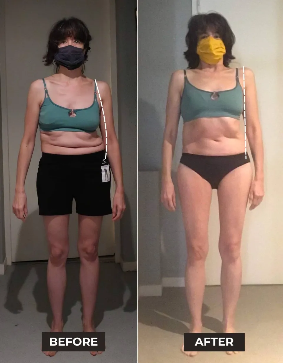 Same client from the front before and after training: uneven shoulders and a collapsed midsection before, a level, upright stance after