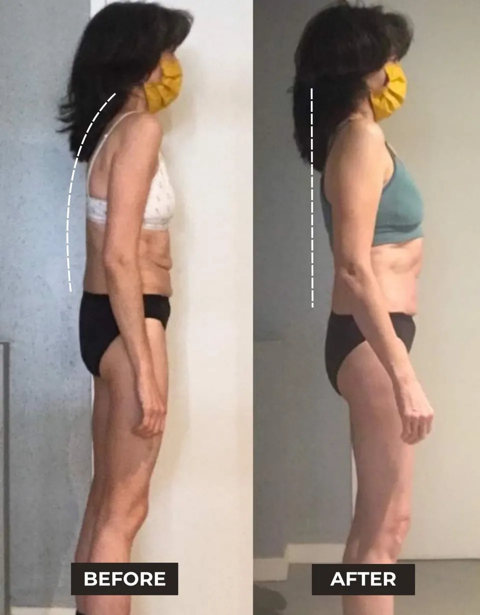 Client side profile before and after training: a forward head and rounded upper back before, upright posture after